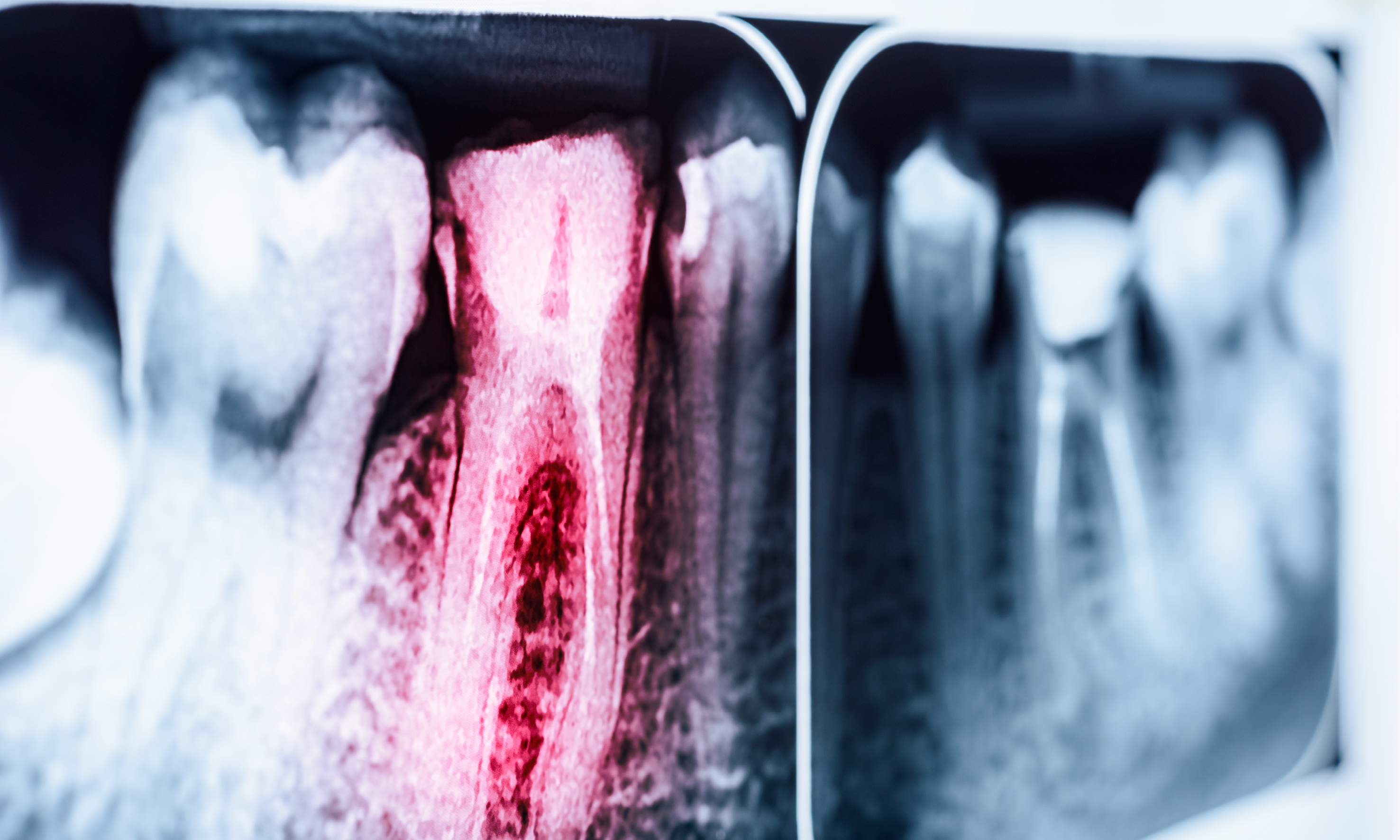 ADA NSW Mini-Residency in Endodontics