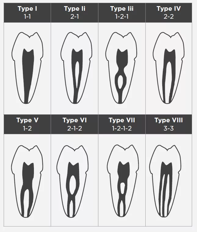 classes of teeth