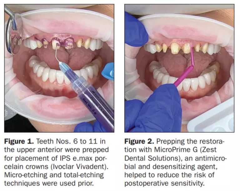 dr savage obu360 case