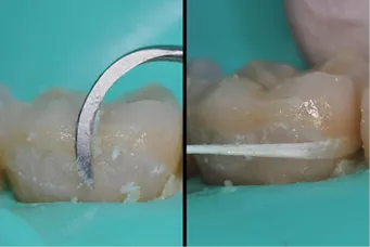 Step curing technique