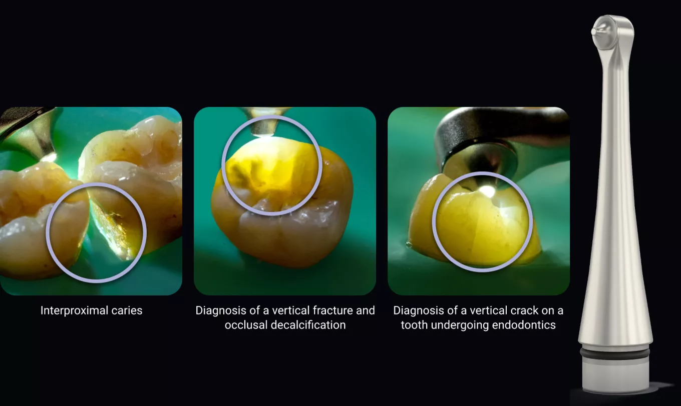 Transillumination tip images