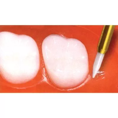 NTISoftTissueTrimmer