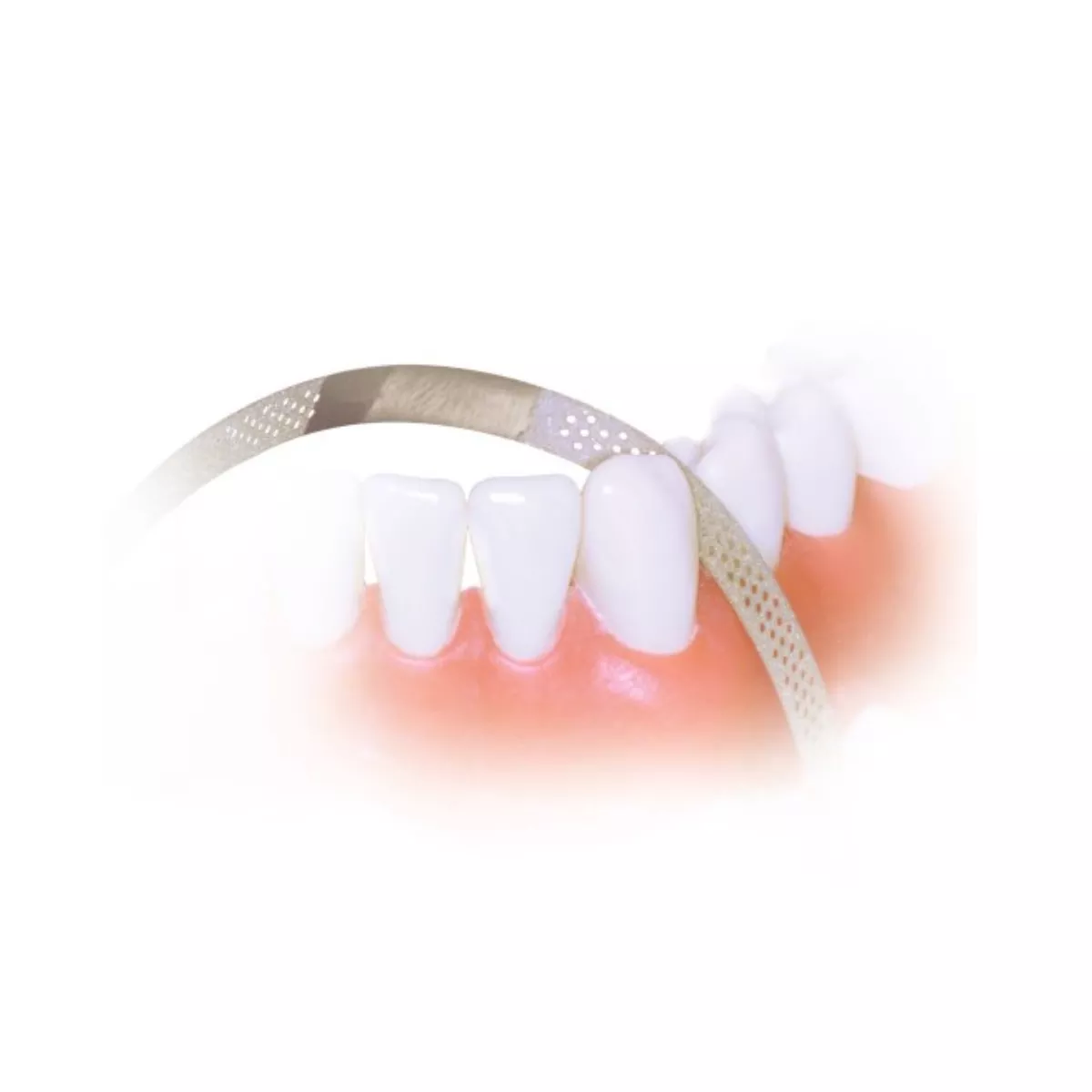 PerforatedDiamondFinishingStrips